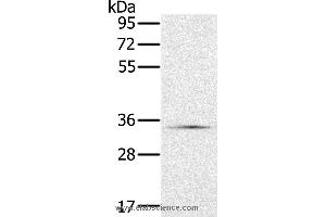 Western blot analysis of Hela cell, using NDUFA9 Polyclonal Antibody at dilution of 1:400 (NDUFA9 anticorps)