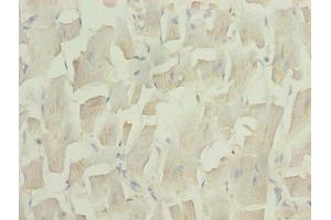 Immunohistochemistry of paraffin-embedded human heart tissue using ABIN7159955 at dilution of 1:100