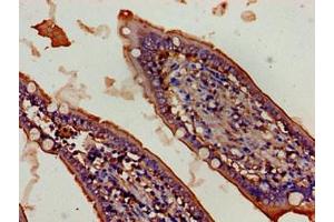 Immunohistochemistry of paraffin-embedded human small intestine tissue using ABIN7152499 at dilution of 1:100