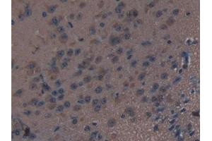 Detection of THBS1 in Mouse Brain Tissue using Polyclonal Antibody to Thrombospondin 1 (THBS1)