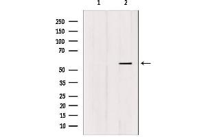 Western blot analysis of extracts from HUVEC, using FOXC1/2 Antibody. (FOXC1 anticorps)