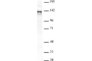 PHF8 pAb tested by Western blot. (PHF8 anticorps)