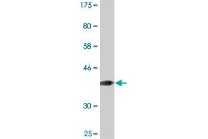 Western Blot detection against Immunogen (36. (MTA1 anticorps  (AA 601-700))