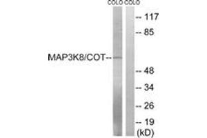 Western blot analysis of extracts from COLO205 cells, treated with Insulin 0. (MAP3K8 anticorps  (AA 366-415))