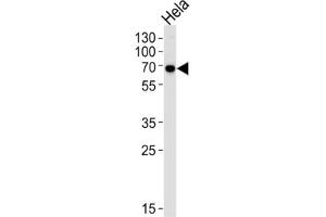 Western Blotting (WB) image for anti-Kinesin Light Chain 1 (KLC1) antibody (ABIN3003845) (KLC1 anticorps)
