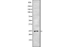 Western blot analysis of ASCL1 using RAW264. (ASCL1 anticorps  (C-Term))