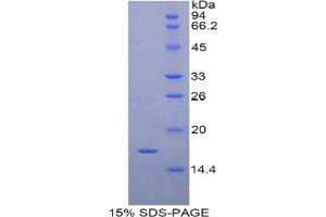 SDS-PAGE analysis of Pig RBP7 Protein. (RBP7 Protéine)
