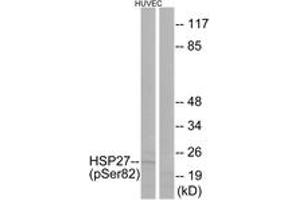 Western blot analysis of extracts from HuvEc cells treated with TNF 20ng/ml 30', using HSP27 (Phospho-Ser82) Antibody. (HSP27 anticorps  (pSer82))