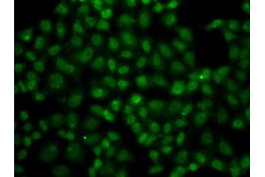 Immunofluorescence analysis of A549 cell using USP26 antibody. (USP26 anticorps)