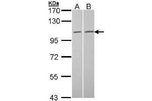 TUBGCP2 anticorps  (N-Term)