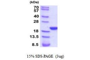 SDS-PAGE (SDS) image for Peptidylprolyl Isomerase F (PPIF) (AA 30-206) protein (His tag) (ABIN5854291) (PPIF Protein (AA 30-206) (His tag))