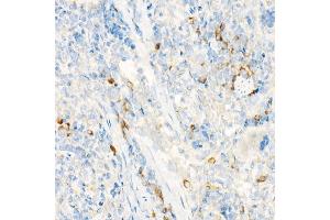 Immunohistochemistry of paraffin-embedded rat spleen using IL27RA Rabbit pAb (ABIN6128083, ABIN6142374, ABIN6142375 and ABIN6224203) at dilution of 1:25 (40x lens). (IL27 Receptor alpha anticorps  (AA 33-283))
