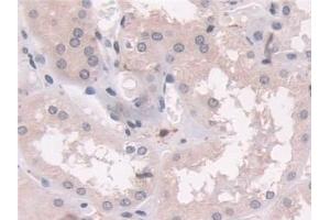 Detection of TAGLN in Human Kidney Tissue using Polyclonal Antibody to Transgelin (TAGLN)