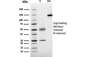 SDS-PAGE Analysis Purified PTH Mouse Recombinant Monoclonal Antibody (rPTH/911). (Recombinant PTH anticorps  (AA 1-34))
