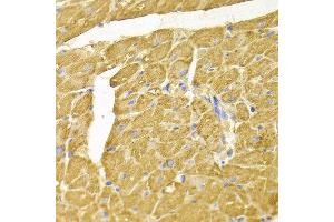 Immunohistochemistry of paraffin-embedded rat heart using NDRG1 antibody at dilution of 1:100 (x400 lens).