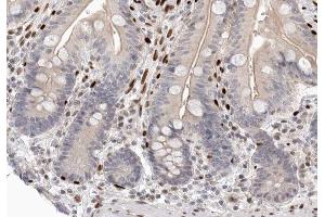 ABIN6266728 at 1/100 staining human colon tissue sections by IHC-P.