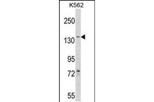 Western blot analysis of hAGL-C371 in K562 cell line lysates (35ug/lane) (AGL anticorps  (AA 357-387))