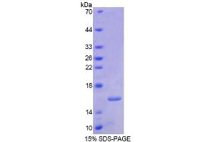 SDS-PAGE analysis of Human RARa Protein. (Retinoic Acid Receptor alpha Protéine)