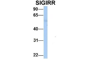 Host:  Rabbit  Target Name:  SIGIRR   Sample Type:  Human Adult Placenta  Antibody Dilution:  1. (SIGIRR anticorps  (C-Term))