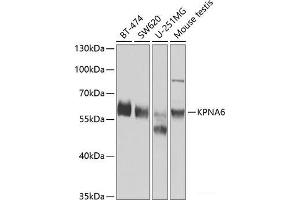 Western blot analysis of extracts of various cell lines using KPNA6 Polyclonal Antibody at dilution of 1:1000. (KPNA6 anticorps)
