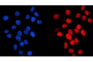 IF analysis of GATA6 using anti-GATA6 antibody (ABIN7599662). (GATA6 anticorps  (AA 105-151))