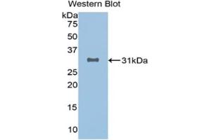 Detection of Recombinant SIRT3, Human using Monoclonal Antibody to Sirtuin 3 (SIRT3) (SIRT3 anticorps  (AA 126-399))