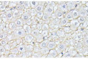 Immunohistochemistry of paraffin-embedded Rat liver using SPTAN1 Polyclonal Antibody at dilution of 1:100 (40x lens). (SPTAN1 anticorps)