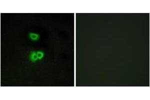 Immunofluorescence analysis of A549 cells, using GPR101 Antibody. (GPR101 anticorps  (AA 245-294))