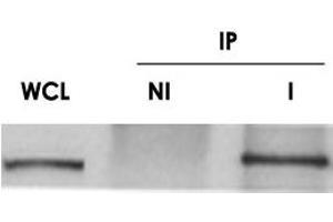 Western blot on human HeLa whole cell lysate (WCL) and ch-TOG immunoprecipitated (I) from mouse embryonic fibroblast whole cell lysate.