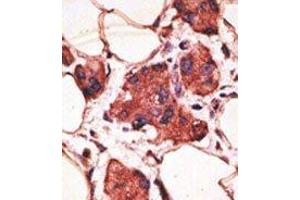 Image no. 2 for anti-Melanoma Antigen Family A, 9 (MAGEA9) (Middle Region) antibody (ABIN358651) (MAGEA9 anticorps  (Middle Region))