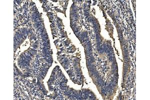 IHC analysis of Sorbitol Dehydrogenase/ SORD using anti-Sorbitol Dehydrogenase/ SORD antibody (ABIN7602486).