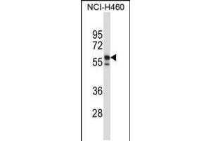 Western blot analysis in NCI-H460 cell line lysates (35ug/lane). (Keratin 6B anticorps  (AA 207-236))