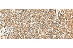 Immunohistochemistry of paraffin-embedded Human tonsil tissue using GRIPAP1 Polyclonal Antibody at dilution of 1:50(x200) (GRIPAP1 anticorps)