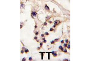 Formalin-fixed and paraffin-embedded human testis tissue reacted with TESK2 polyclonal antibody  , which was peroxidase-conjugated to the secondary antibody, followed by DAB staining. (TESK2 anticorps  (Internal Region))