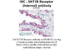Image no. 1 for anti-Serotonin Receptor 1B (HTR1B) (Internal Region) antibody (ABIN1731348)