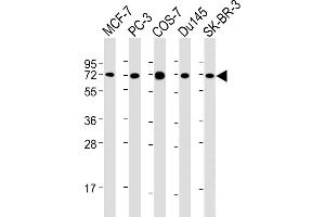 All lanes : Anti-USP2 Antibody at 1:2000 dilution Lane 1: MCF-7 whole cell lysate Lane 2: PC-3 whole cell lysate Lane 3: COS-7 whole cell lysate Lane 4: Du145 whole cell lysate Lane 5: SK-BR-3 whole cell lysate Lysates/proteins at 20 μg per lane. (USP2 anticorps  (AA 1-258))