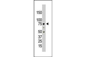 The PRMT5 polyclonal antibody  is used in Western blot to detect PRMT5 in HL-60 cell lysate. (PRMT5 anticorps  (C-Term))