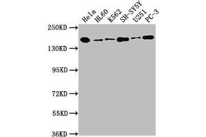 Western Blot Positive WB detected in: Hela whole cell lysate, HL60 whole cell lysate, K562 whole cell lysate, SH-SY5Y whole cell lysate, U251 whole cell lysate, PC-3 whole cell lysate All lanes: DOT1L antibody at 1:1500 Secondary Goat polyclonal to rabbit IgG at 1/50000 dilution Predicted band size: 165, 185 kDa Observed band size: 185 kDa (Recombinant DOT1L anticorps)