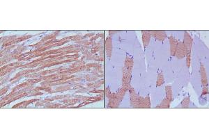Immunohistochemical analysis of paraffin-embedded human skeletal muscle (left) and cardiac muscle (right) using MYL3 mouse mAb with DAB staining. (MYL3/CMLC1 anticorps)