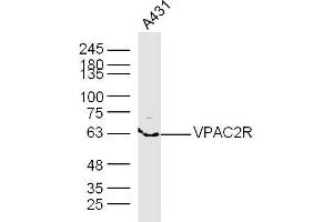 A431 lysates probed with VPAC2R Polyclonal Antibody, Unconjugated  at 1:300 dilution and 4˚C overnight incubation. (VIPR2 anticorps  (AA 81-170))