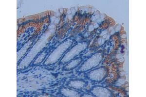 Used in DAB staining on fromalin fixed paraffin- embedded Kidney tissue (CD7 anticorps  (AA 24-150))