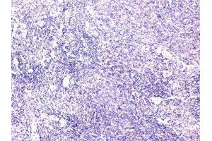 IHC analysis of cortactin using anti-cortactin antibody (ABIN6719306). (Cortactin anticorps  (AA 1-105))