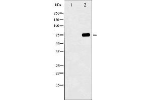 Western blot analysis of Tau phosphorylation expression in UV treated 293 whole cell lysates,The lane on the left is treated with the antigen-specific peptide.
