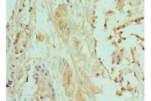 Immunohistochemistry of paraffin-embedded human prostate tissue using ABIN7145331 at dilution of 1:100
