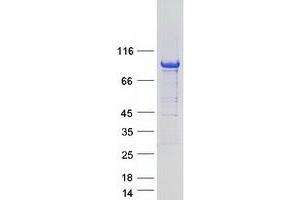 Validation with Western Blot
