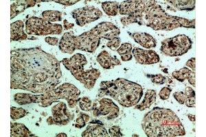 Immunohistochemical analysis of paraffin-embedded human-placenta, antibody was diluted at 1:200 (VEGFR2/CD309 anticorps  (AA 1268-1341))