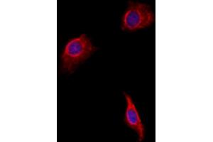 ABIN6257551 and ABIN6275682 staining HepG2 by IF/ICC.