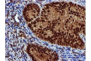 Image no. 1 for anti-EPM2A (Laforin) Interacting Protein 1 (EPM2AIP1) antibody (ABIN1498045) (EPM2AIP1 anticorps)