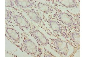 Immunohistochemistry of paraffin-embedded human colon tissue using ABIN7173261 at dilution of 1:100 (TMEM65 anticorps  (AA 63-240))