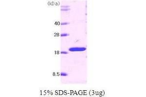 Figure annotation denotes ug of protein loaded and % gel used. (Tumor Necrosis Factor (Ligand) Superfamily, Member 10 (TNFSF10) (AA 114-281) Peptide)